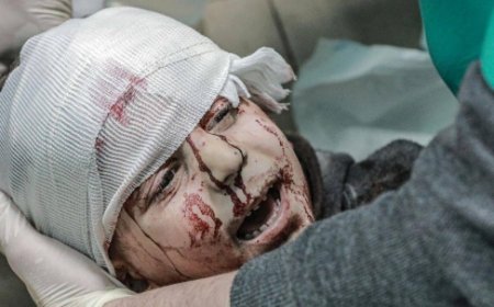 1500مواطنا بغزة فقدوا البصر بسبب الحرب