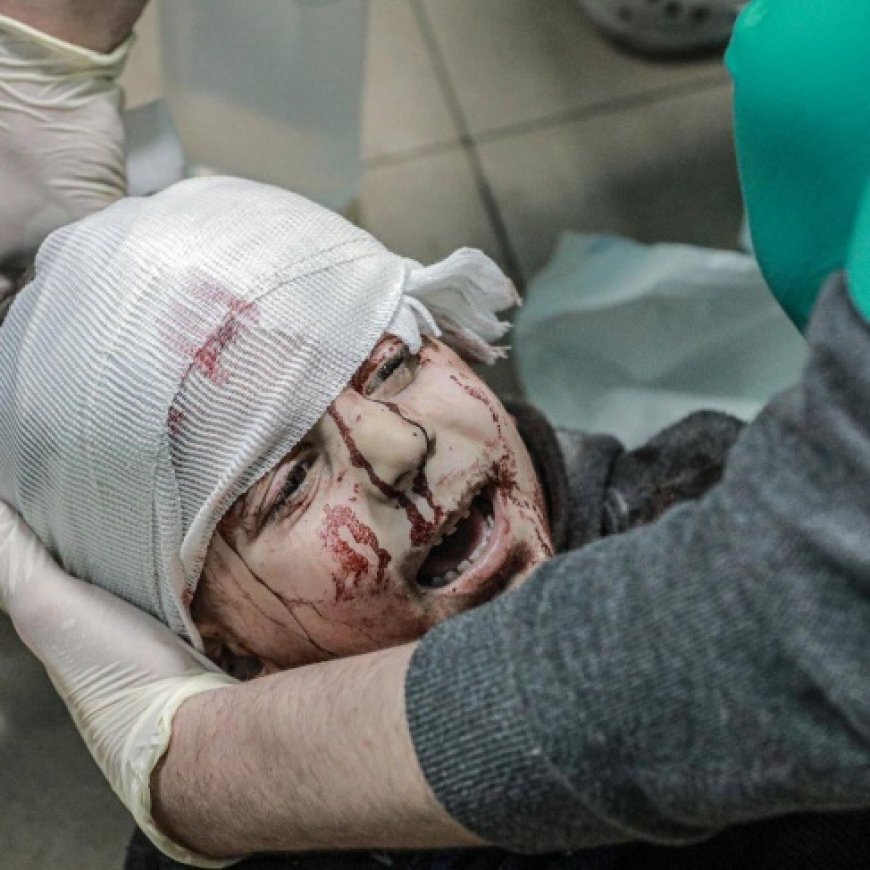 1500مواطنا بغزة فقدوا البصر بسبب الحرب