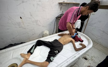 لترتفع الحصيلة إلى 25 منذ الأحد: وفاة طفلين شمال وجنوب قطاع غزة بسبب سوء التغذية والمجاعة