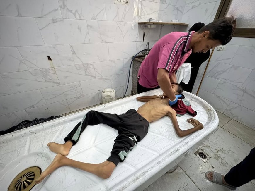 لترتفع الحصيلة إلى 25 منذ الأحد: وفاة طفلين شمال وجنوب قطاع غزة بسبب سوء التغذية والمجاعة