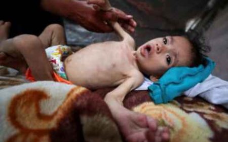 متلازمة “غيلان باريه”.. مرض جديد نادر يفتك بأطفال قطاع غزة بسبب الحرب والحصار والتجويع والصحة تحذر من انتشاره