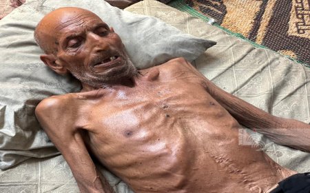 8 وفيات نتيجة المجاعة وسوء التغذية خلال الـ24 ساعة الماضية