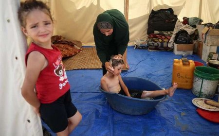 الأونروا: غزة تعاني نقصا حادا في مستلزمات النظافة والصابون بات نادرا