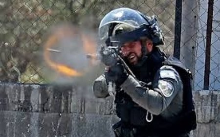 إصابة برصاص الاحتلال شرق القدس