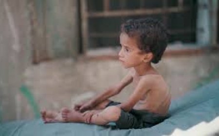 7 حالات وفاة جديدة جراء التجويع وسوء التغذية بغزة