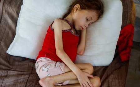 الاحتلال يتعمد تجويع أكثر من 100 ألف طفل ومريض بغزة