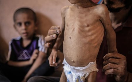 منظمة العفو الدولية تتهم إسرائيل بسياسة تجويع متعمدة في غزة