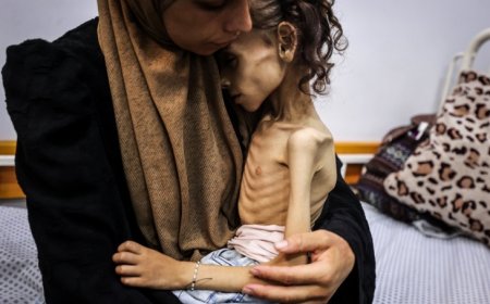 صحة غزة: تسجيل حالتي وفاة جديدتين بالتجويع لترتفع الحصيلة لـ 271