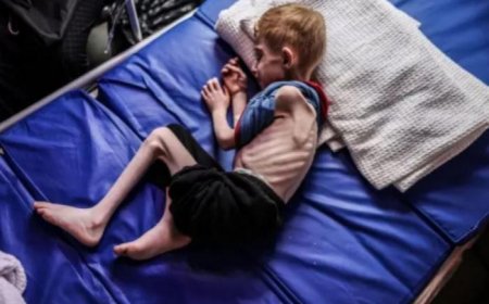 8 وفيات نتيجة المجاعة وسوء التغذية خلال الـ24 ساعة الماضية