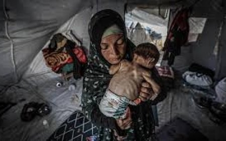 4 وفيات بينهم طفلان نتيجة المجاعة وسوء التغذية خلال الساعات الـ24 الماضية