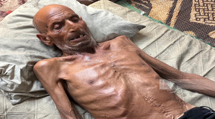 8 وفيات نتيجة المجاعة وسوء التغذية خلال الـ24 ساعة الماضية