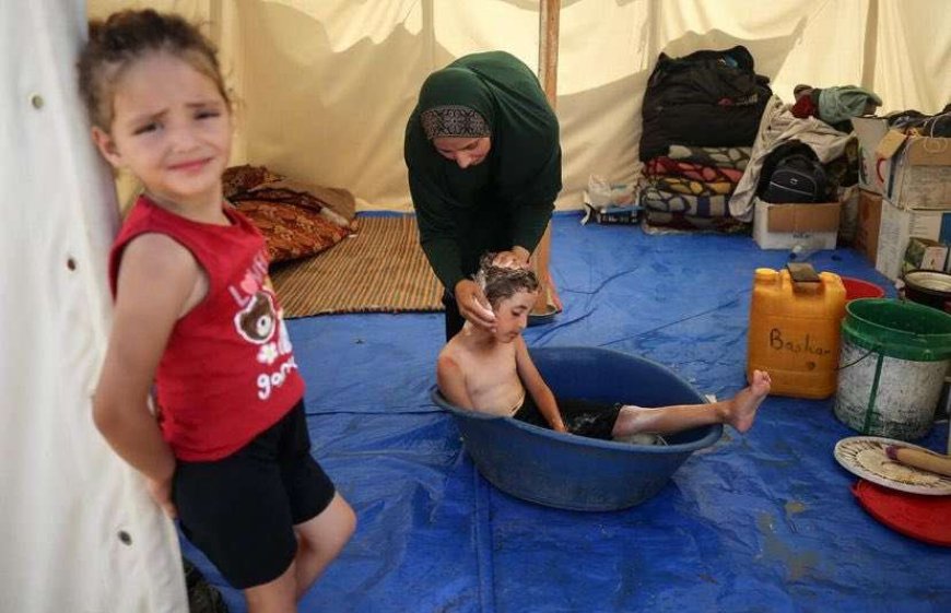 الأونروا: غزة تعاني نقصا حادا في مستلزمات النظافة والصابون بات نادرا
