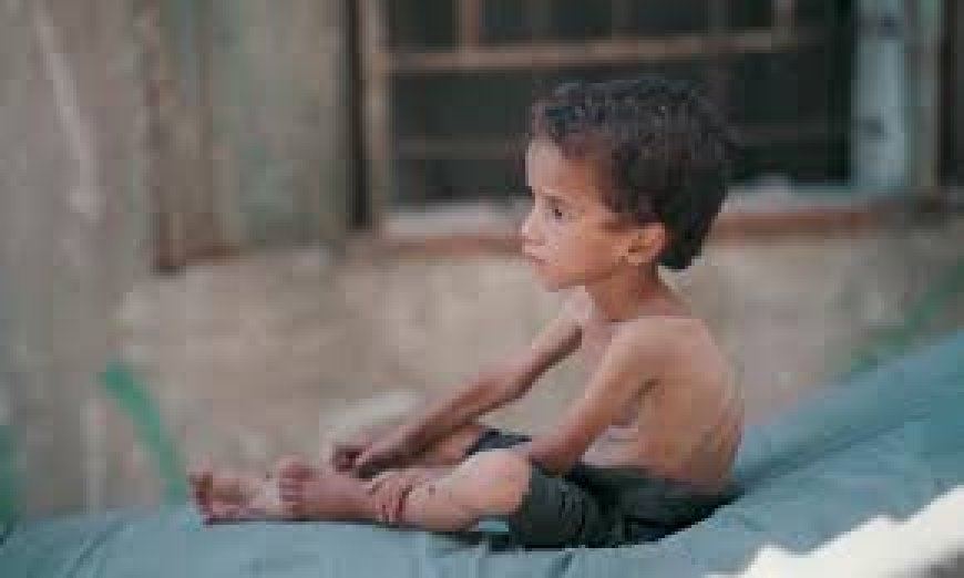 7 حالات وفاة جديدة جراء التجويع وسوء التغذية بغزة
