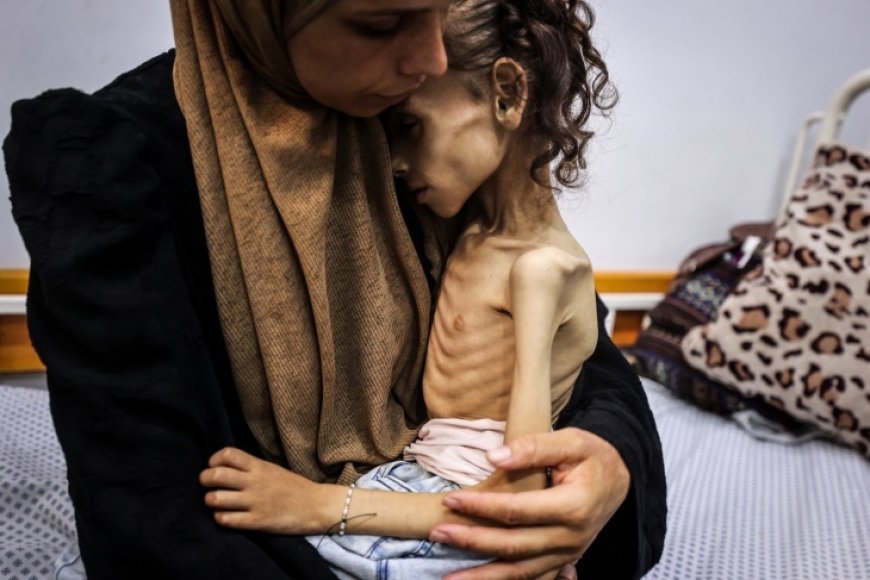 صحة غزة: تسجيل حالتي وفاة جديدتين بالتجويع لترتفع الحصيلة لـ 271