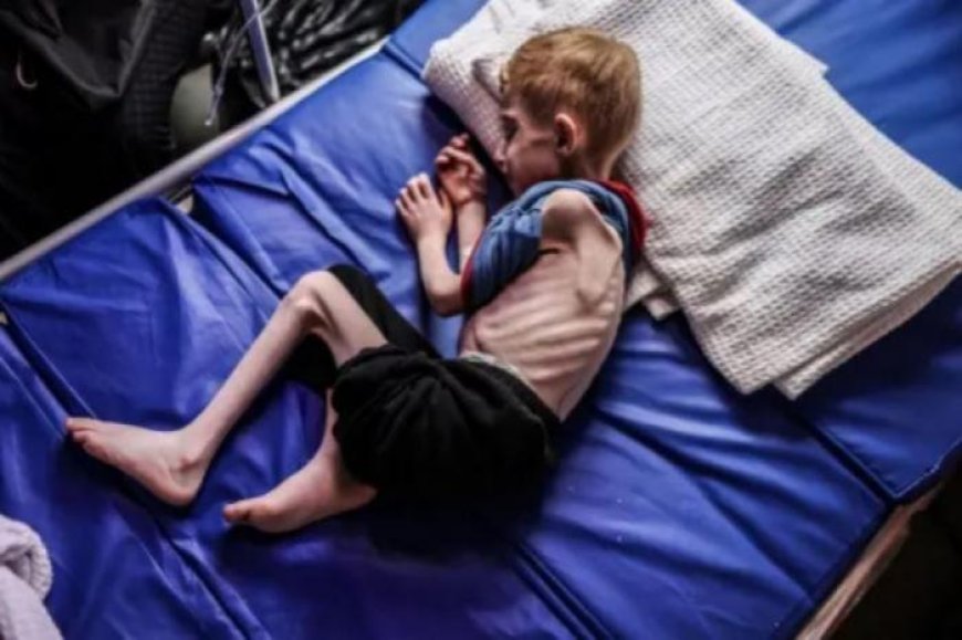 8 وفيات نتيجة المجاعة وسوء التغذية خلال الـ24 ساعة الماضية