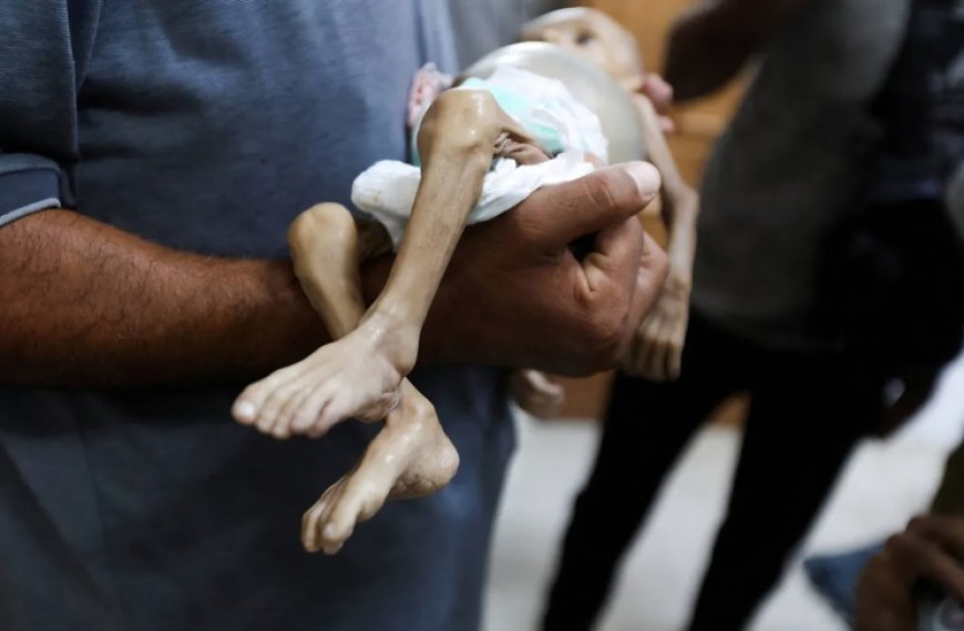 11 حالة وفاة جديدة نتيجة المجاعة بغزة خلال 24 ساعة