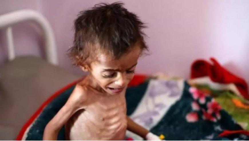 الحصيلة ترتفع لـ 393- ست حالات وفاة جديدة نتيجة المجاعة في قطاع غزة