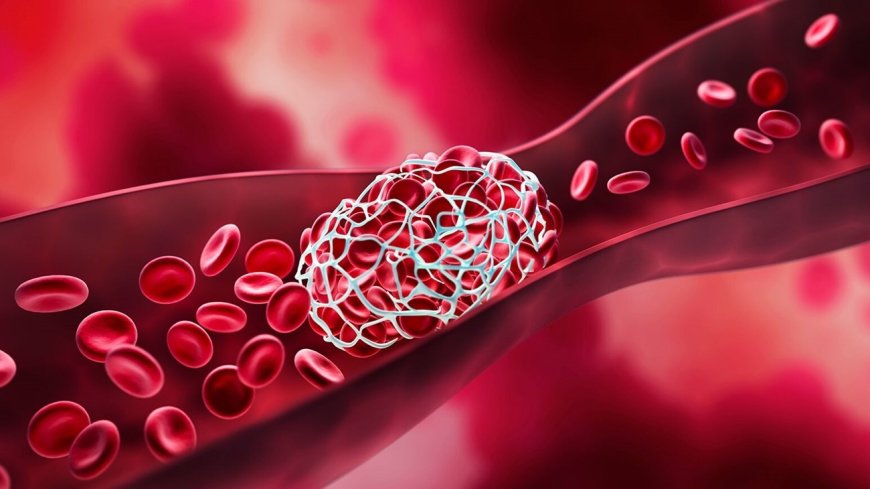 كيف يساعد الذكاء الاصطناعي على منع الجلطات قبل وقوعها؟