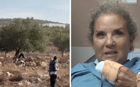 هاكابي يصف الاعتداء على مصورة «واشنطن بوست» بالإرهابي.. وهرتسوغ يعتذر لها